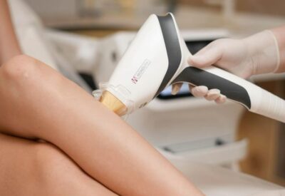 DEPILACION LASER